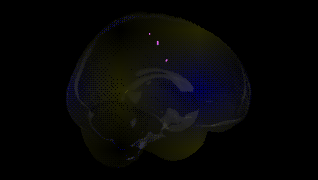 Full Brain Black