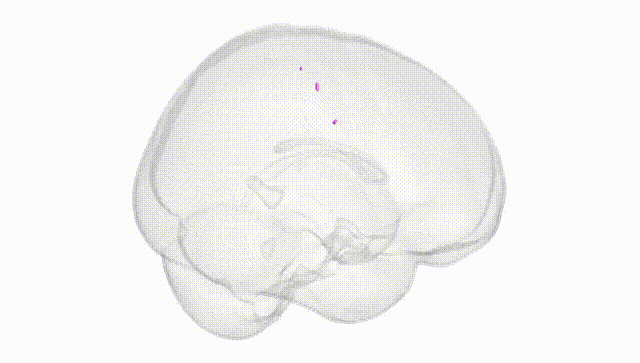 Full Brain White