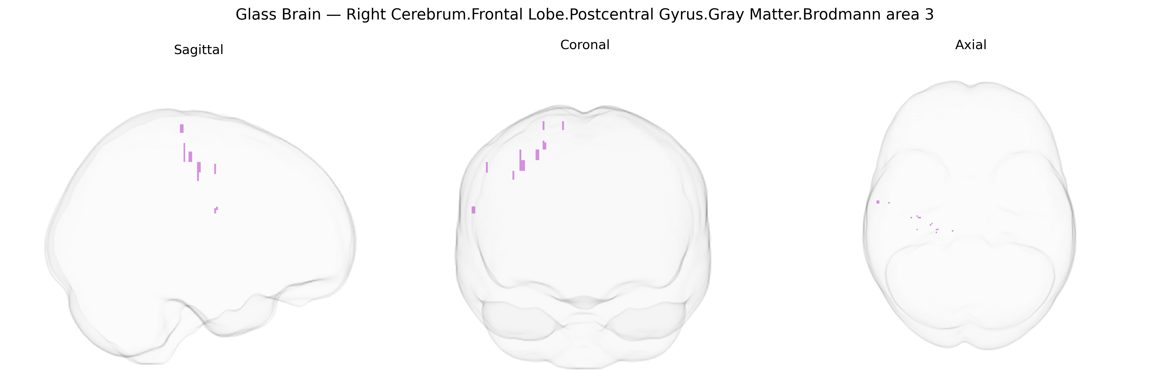 Triplanar Ghost Brain