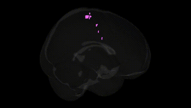 Full Brain Black