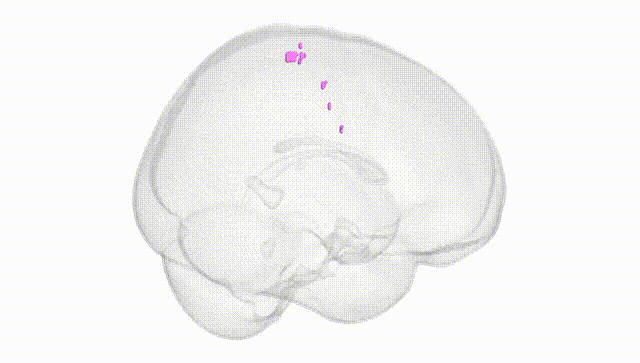 Full Brain White
