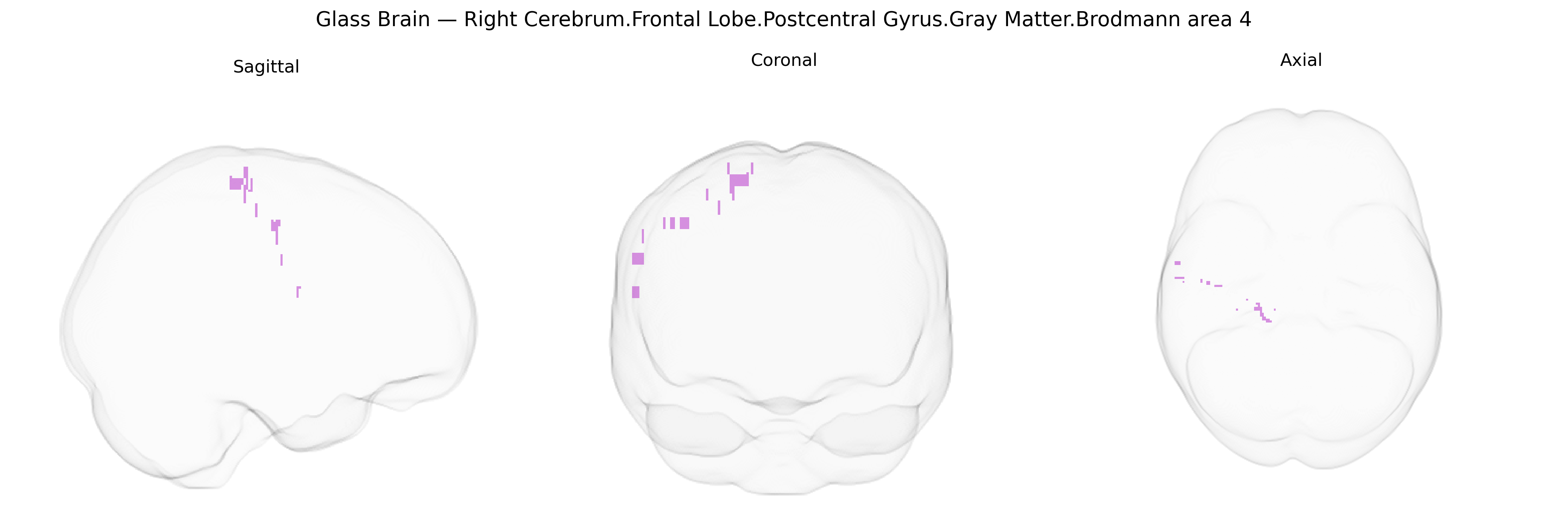 Triplanar Ghost Brain