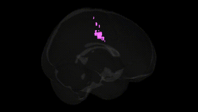 Full Brain Black