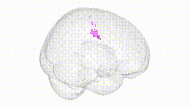 Full Brain White