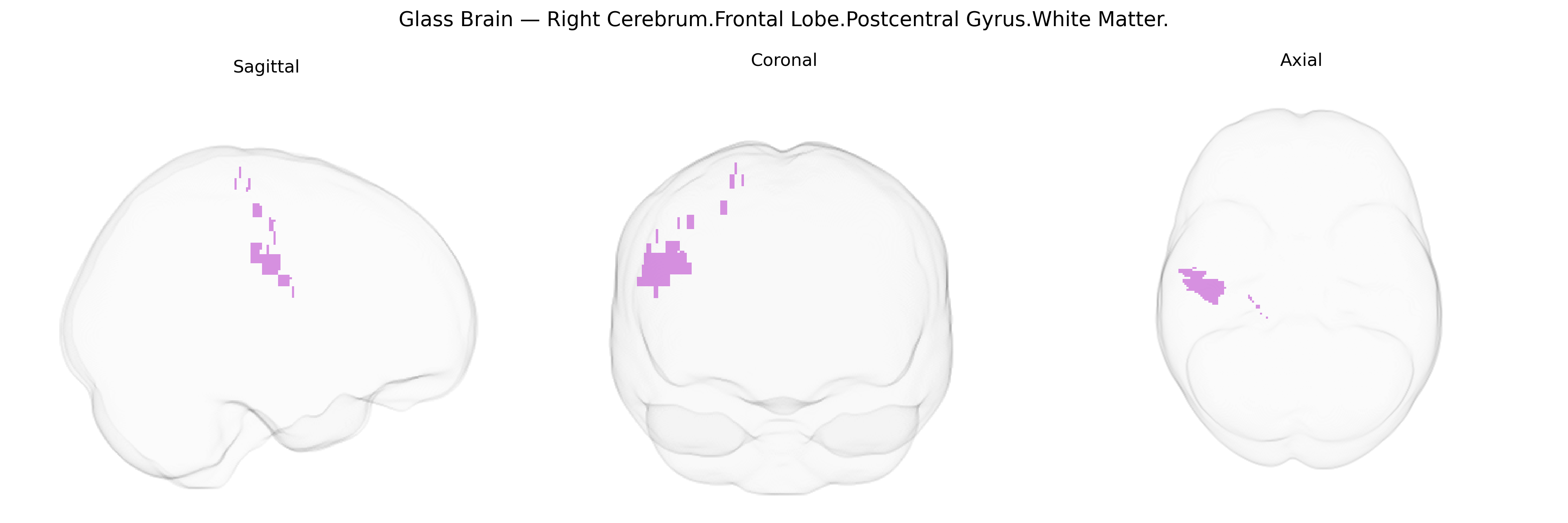 Triplanar Ghost Brain