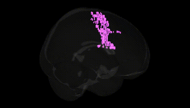 Full Brain Black