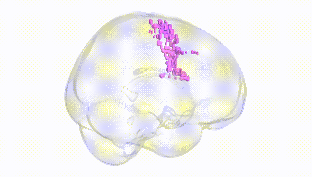 Full Brain White