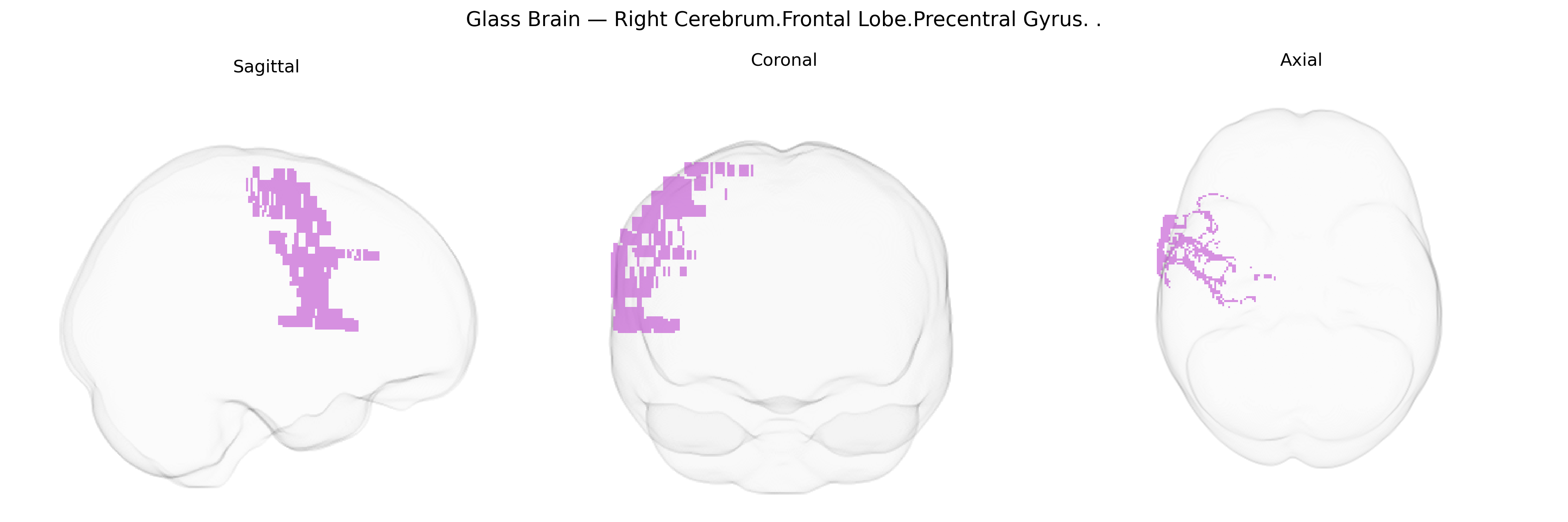Triplanar Ghost Brain