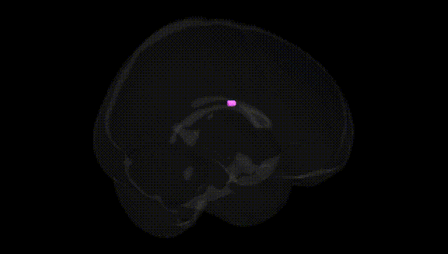 Full Brain Black