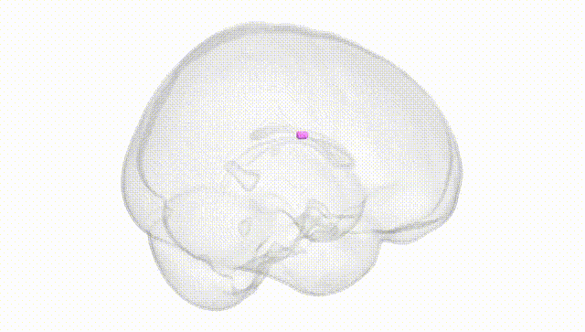 Full Brain White