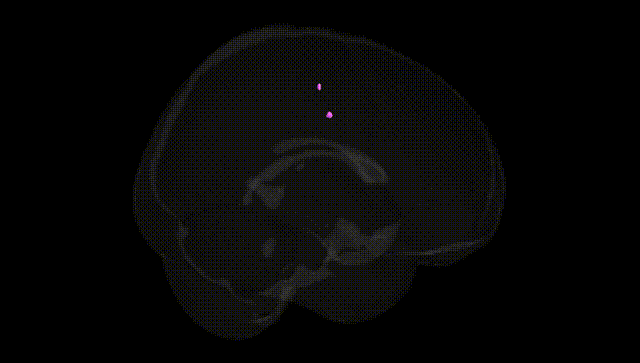 Full Brain Black
