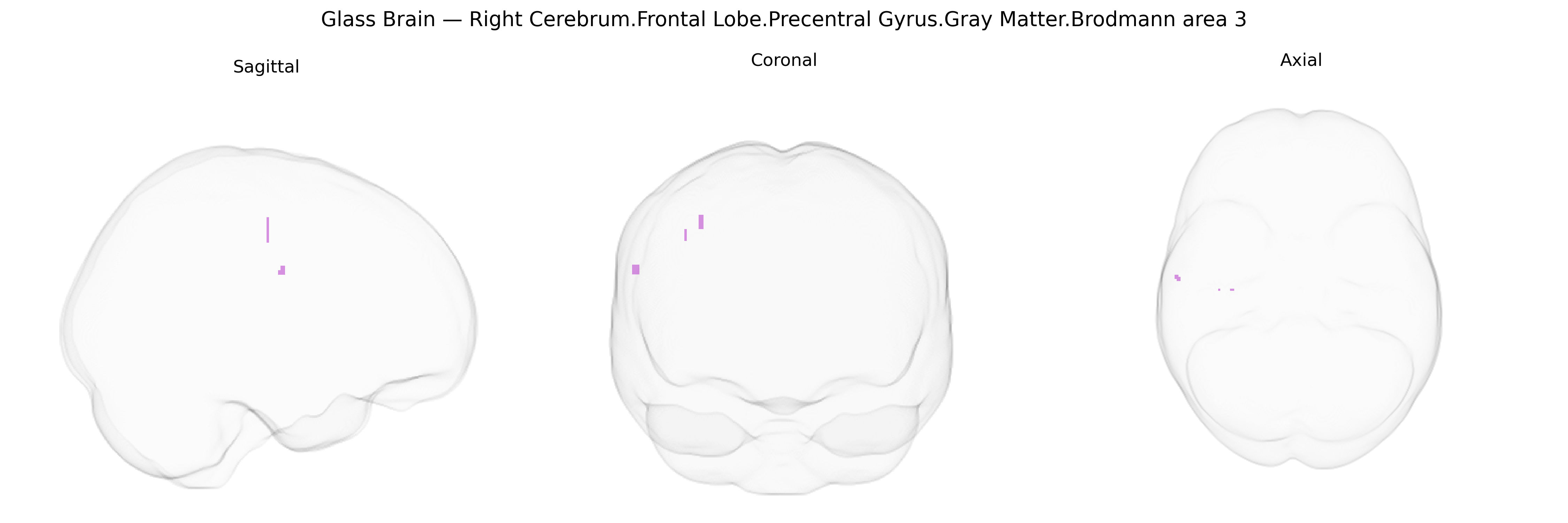 Triplanar Ghost Brain
