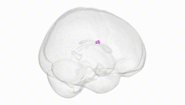 Full Brain White