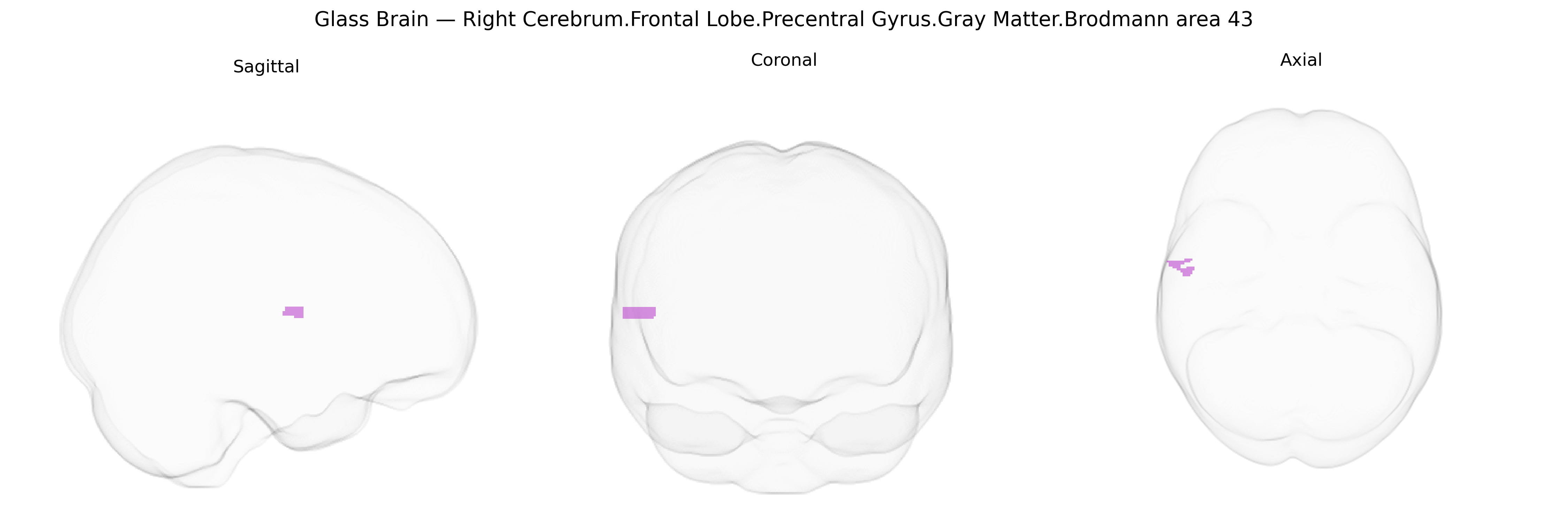 Triplanar Ghost Brain