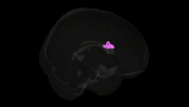 Full Brain Black