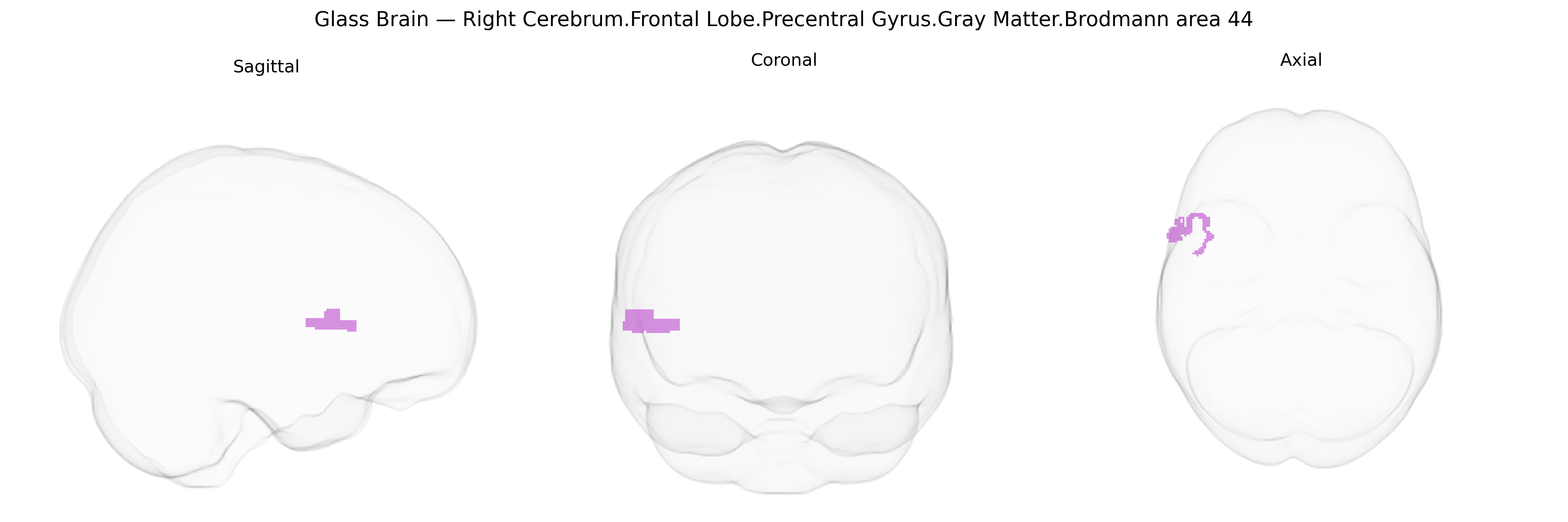Triplanar Ghost Brain