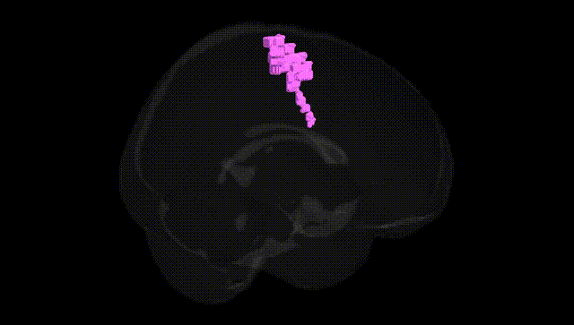 Full Brain Black