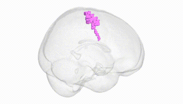 Full Brain White