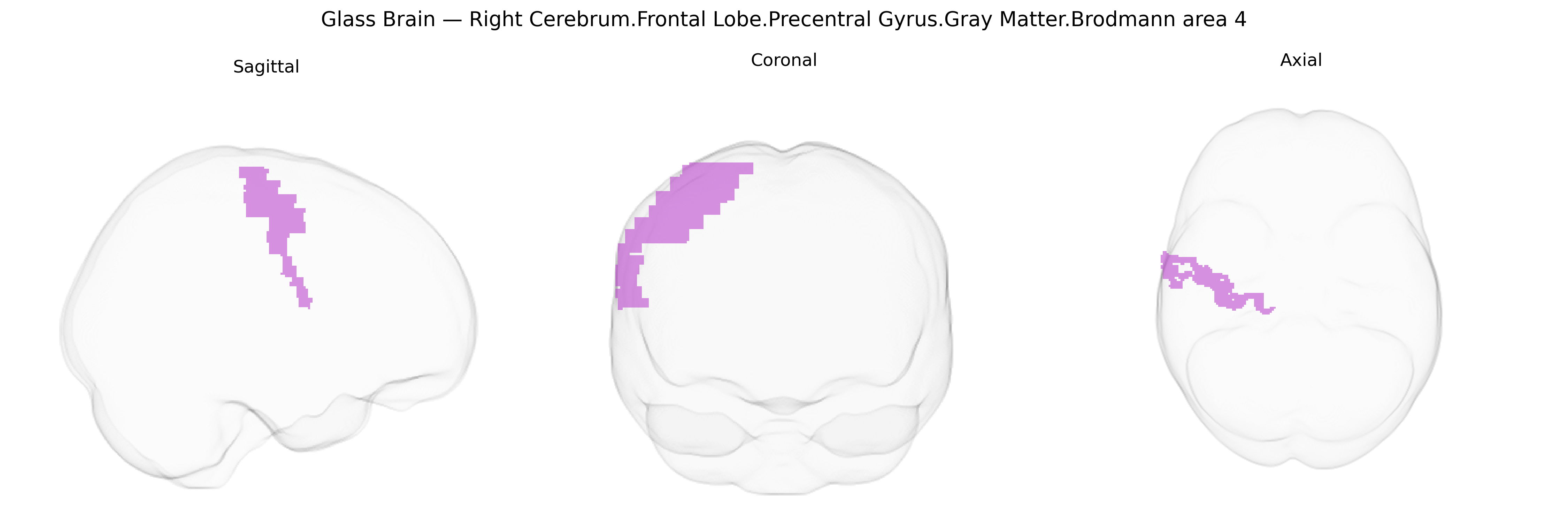 Triplanar Ghost Brain