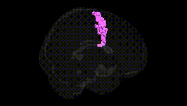 Full Brain Black