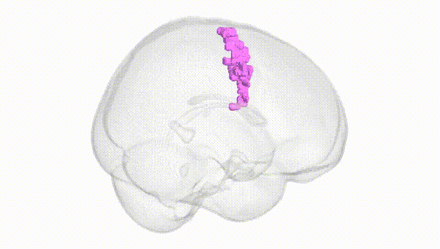 Full Brain White