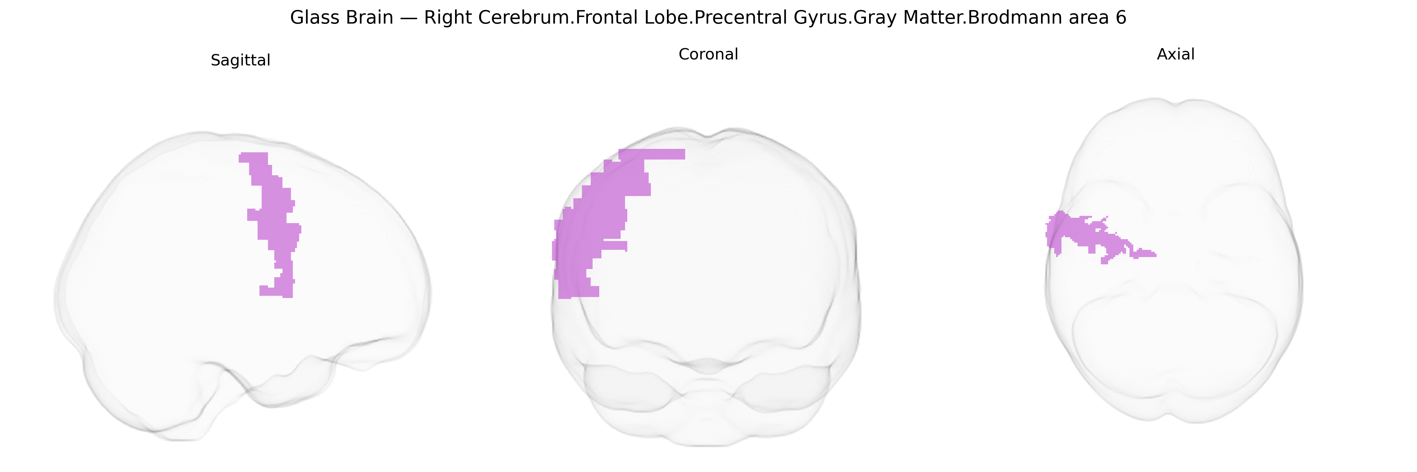 Triplanar Ghost Brain
