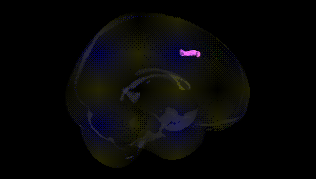 Full Brain Black