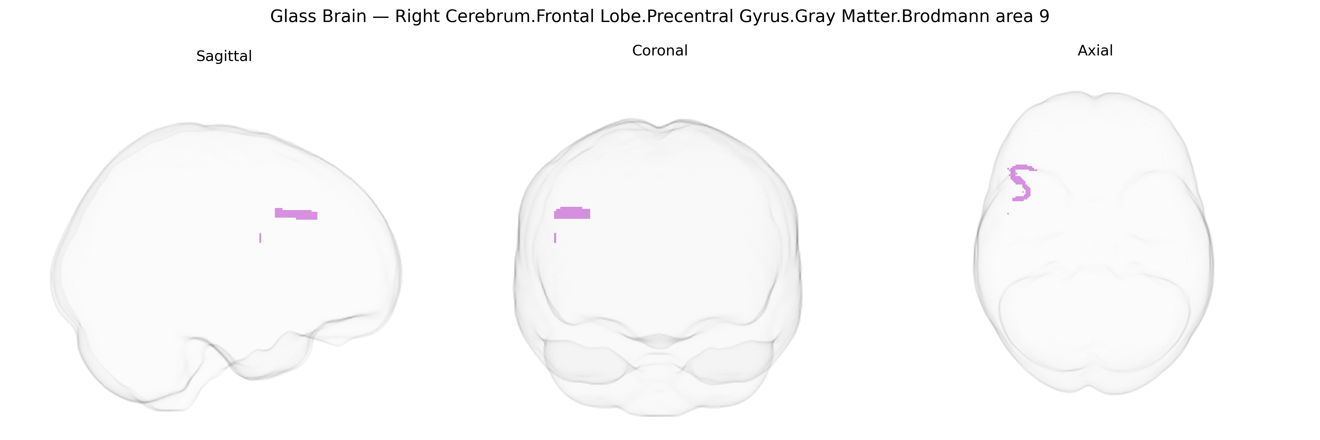 Triplanar Ghost Brain