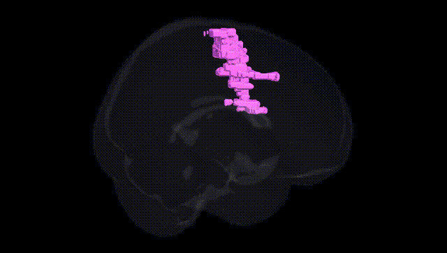 Full Brain Black
