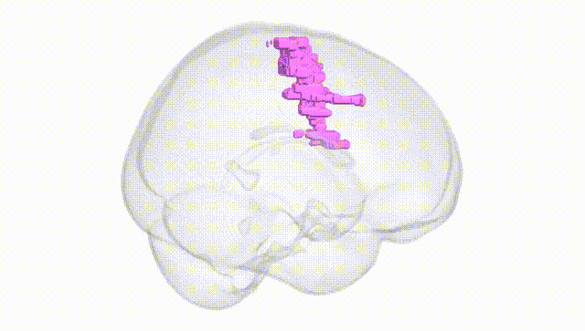 Full Brain White
