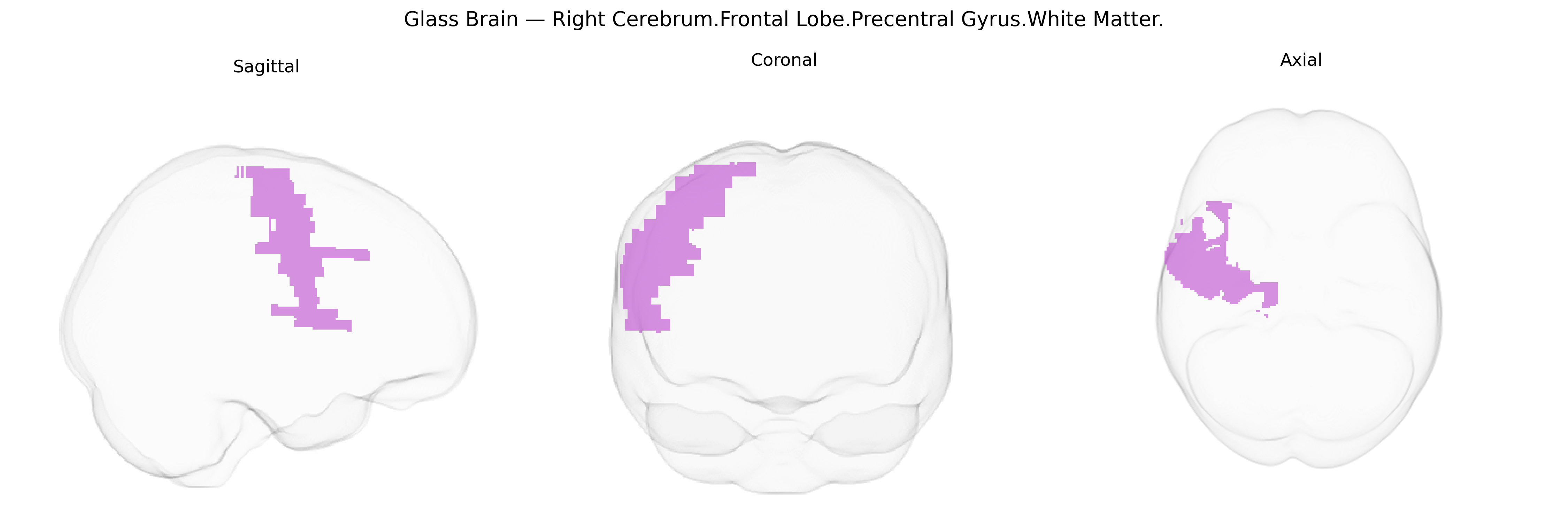 Triplanar Ghost Brain