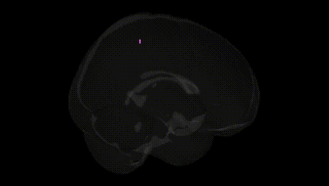 Full Brain Black