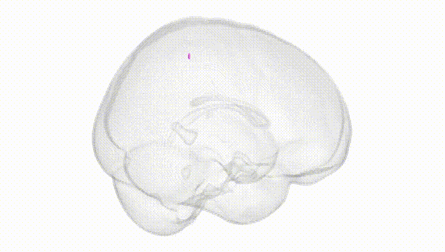 Full Brain White