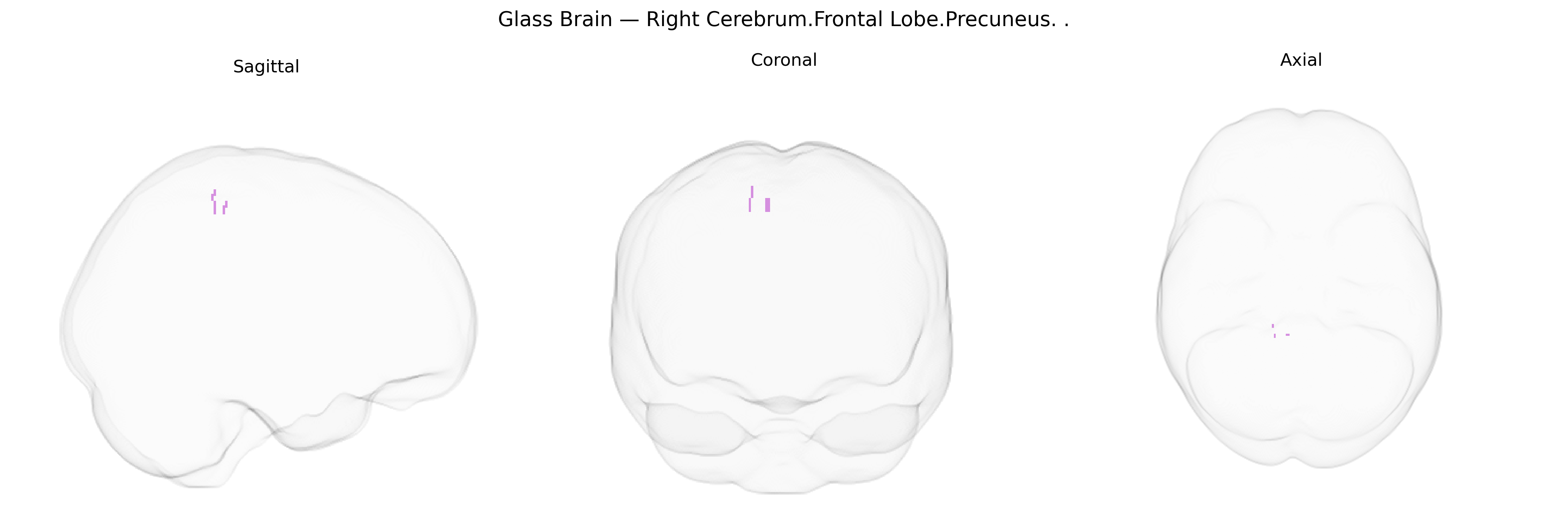 Triplanar Ghost Brain