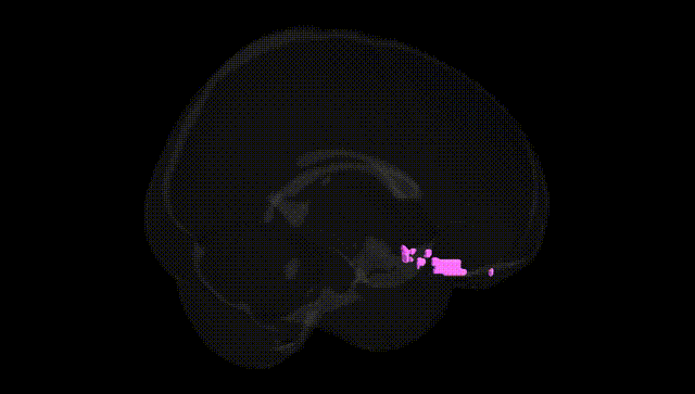 Full Brain Black