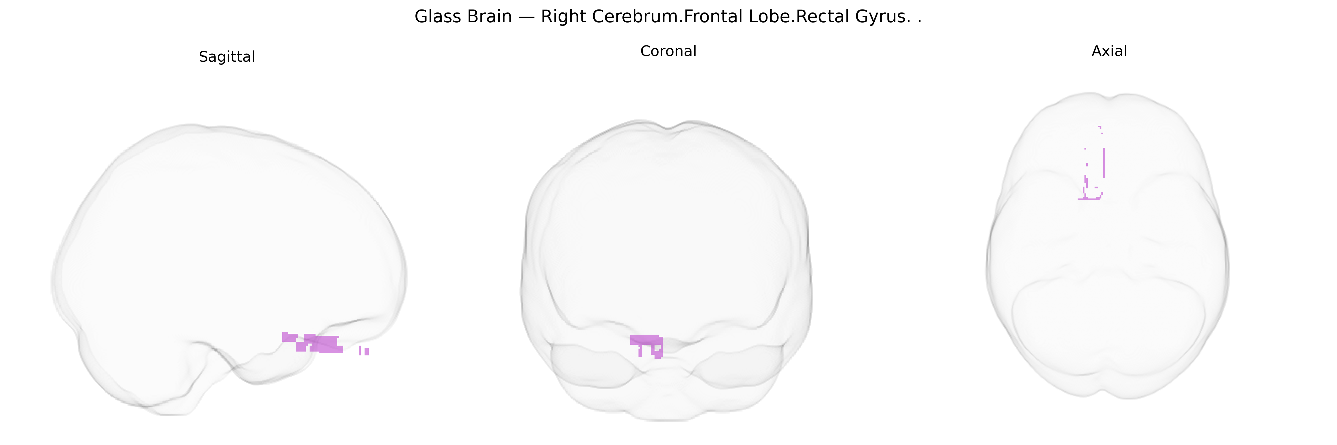 Triplanar Ghost Brain