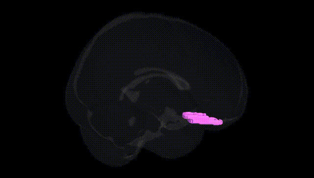 Full Brain Black