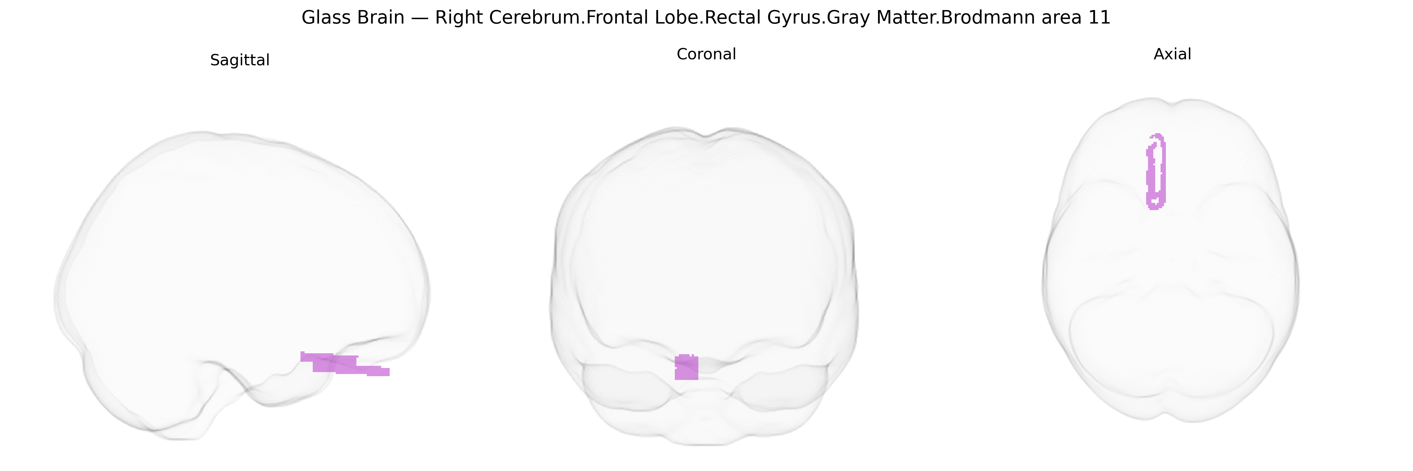Triplanar Ghost Brain