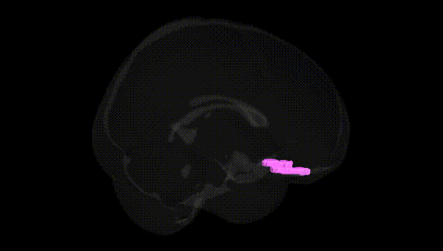 Full Brain Black