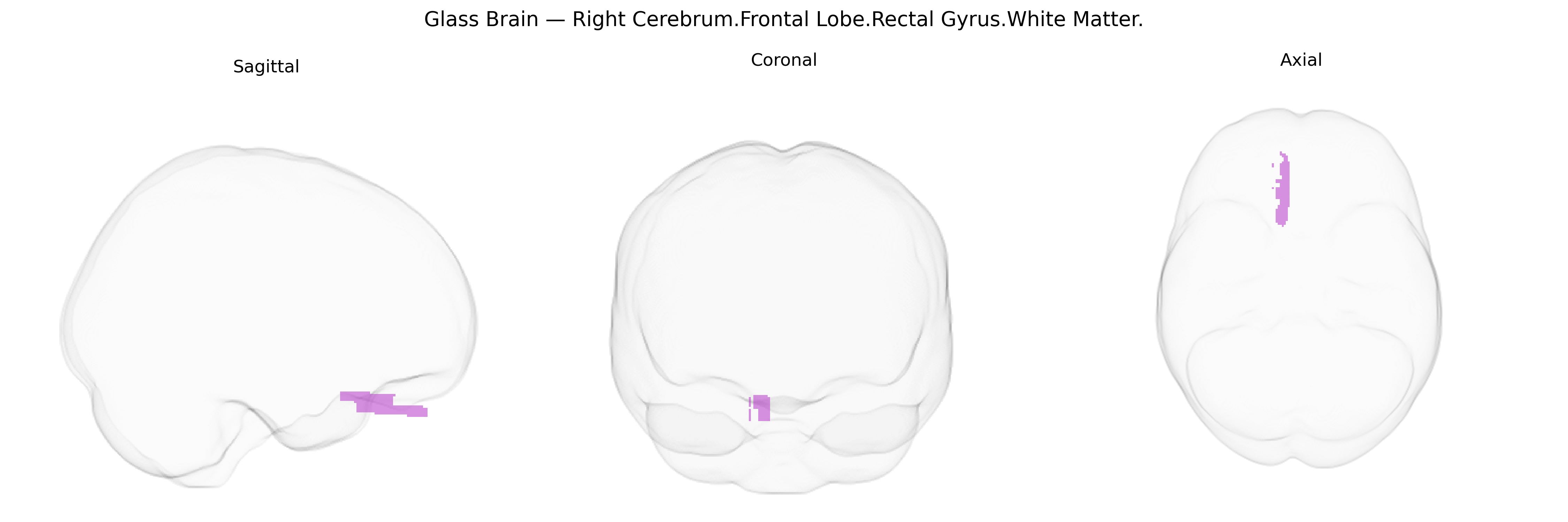 Triplanar Ghost Brain