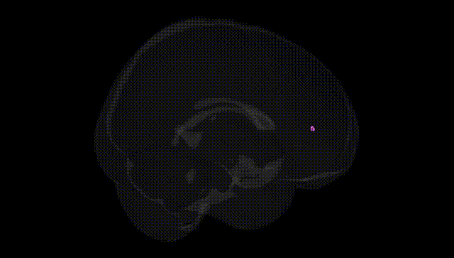 Full Brain Black