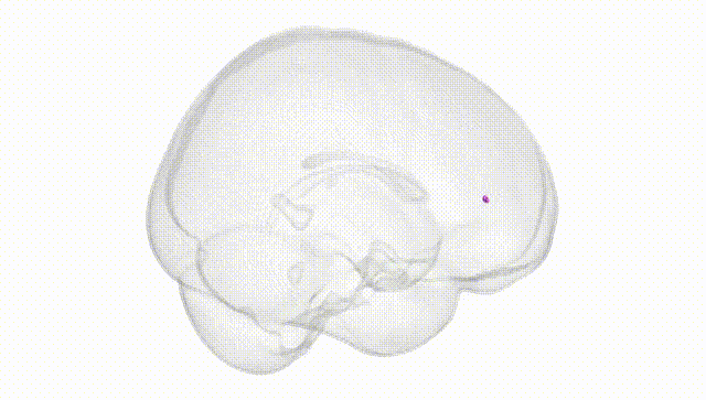 Full Brain White