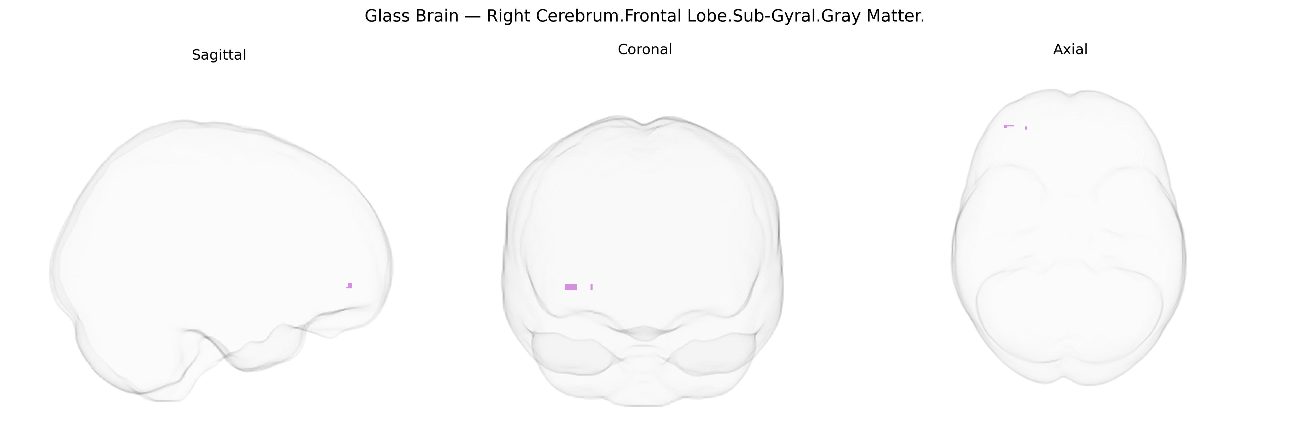Triplanar Ghost Brain