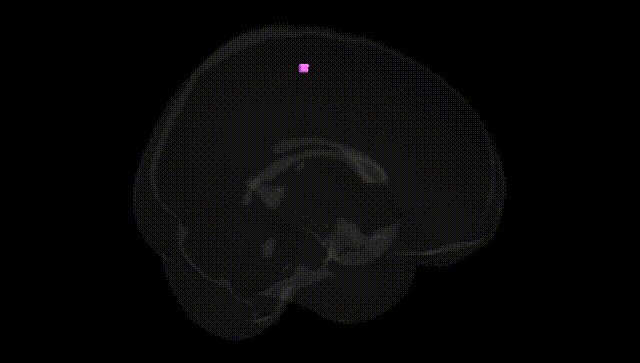 Full Brain Black