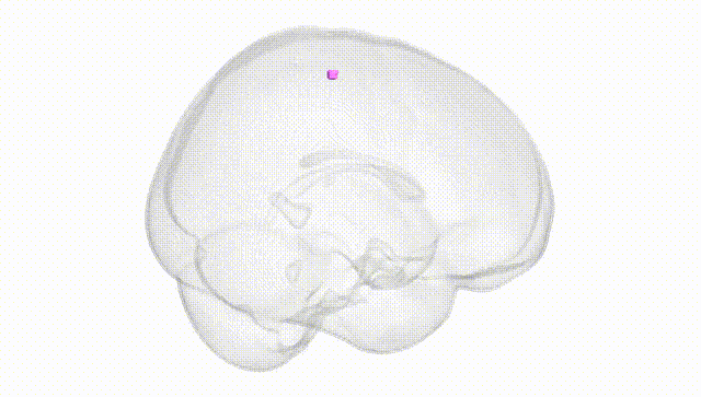 Full Brain White