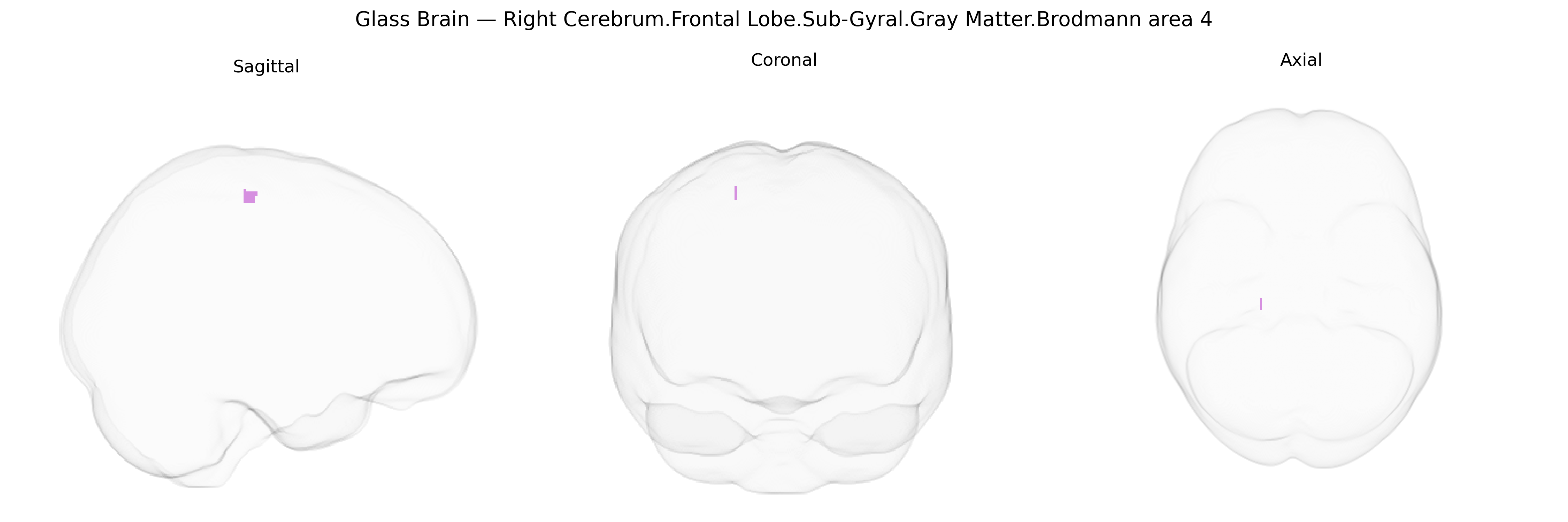 Triplanar Ghost Brain