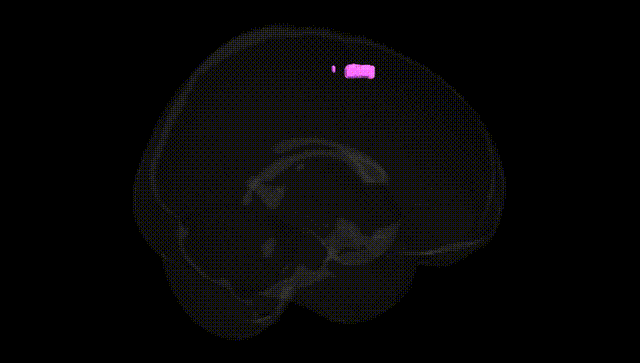 Full Brain Black