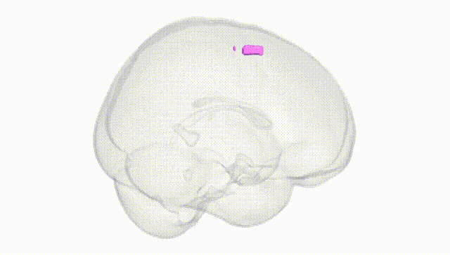Full Brain White