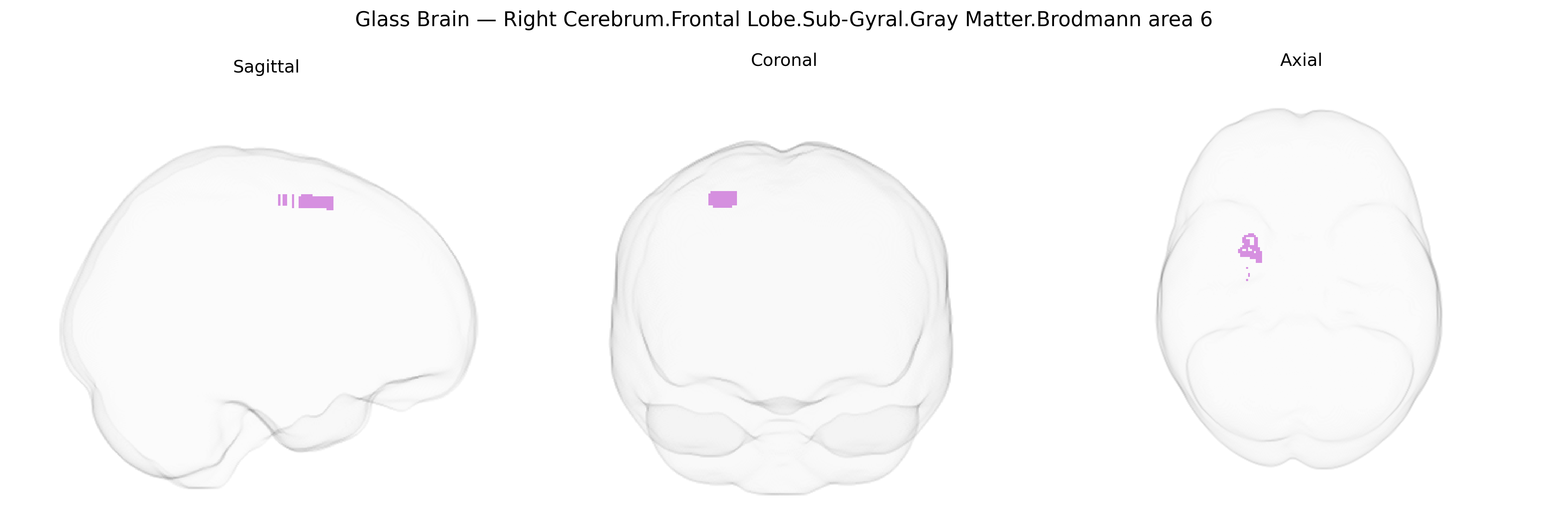 Triplanar Ghost Brain