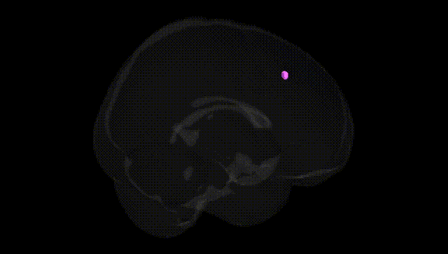 Full Brain Black